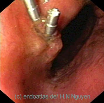 © Med-Serv.de-H.N.